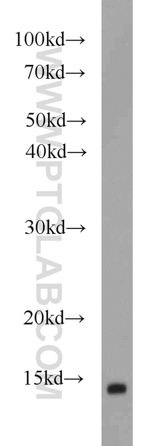 FABP7 Antibody in Western Blot (WB)