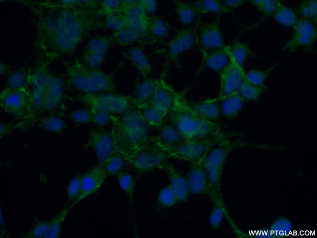 RTKN2 Antibody in Immunocytochemistry (ICC/IF)