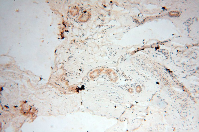 RTKN2 Antibody in Immunohistochemistry (Paraffin) (IHC (P))