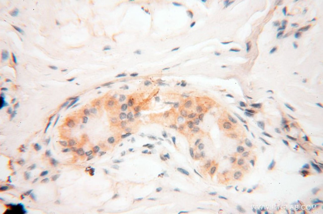 RTKN2 Antibody in Immunohistochemistry (Paraffin) (IHC (P))