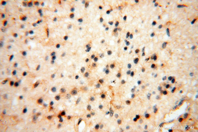 RTKN2 Antibody in Immunohistochemistry (Paraffin) (IHC (P))