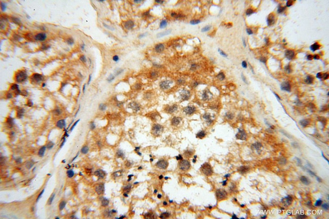 RTKN2 Antibody in Immunohistochemistry (Paraffin) (IHC (P))