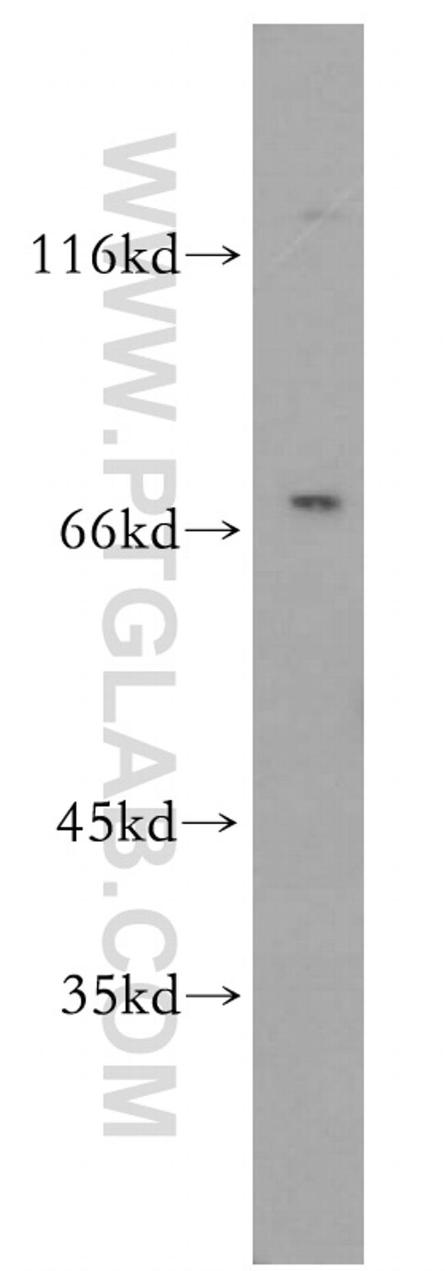 RTKN2 Antibody in Western Blot (WB)