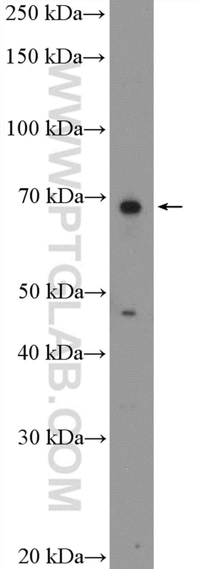 RTKN2 Antibody in Western Blot (WB)