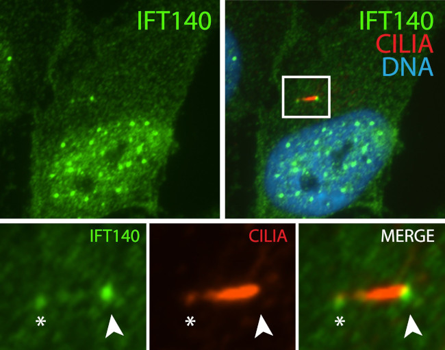 IFT140 Antibody in Immunocytochemistry (ICC/IF)