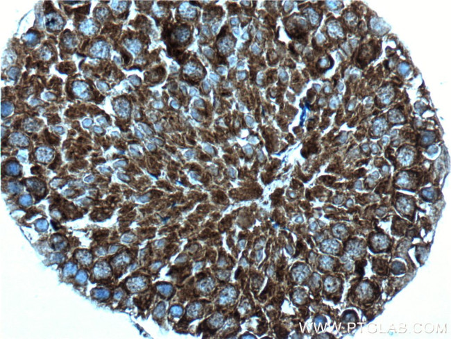 IFT140 Antibody in Immunohistochemistry (Paraffin) (IHC (P))