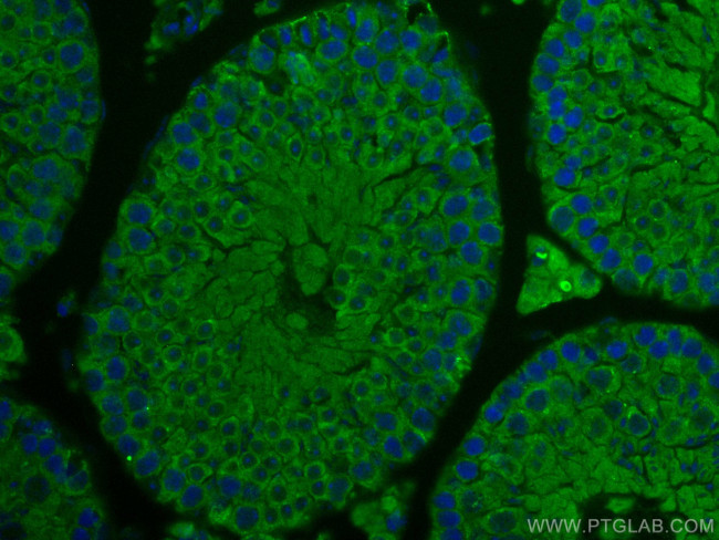 IFT140 Antibody in Immunohistochemistry (PFA fixed) (IHC (PFA))