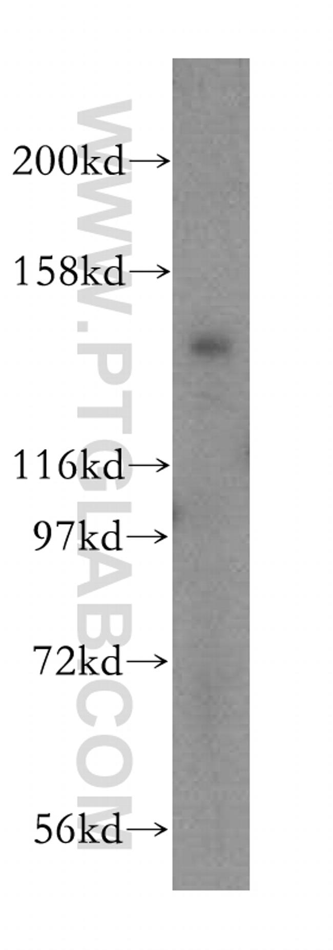 IFT140 Antibody in Western Blot (WB)