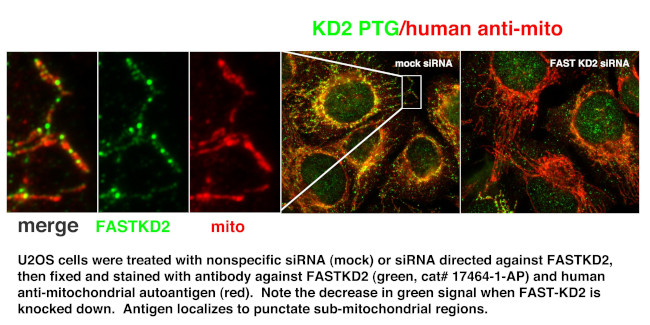 FASTKD2 Antibody in Immunocytochemistry (ICC/IF)