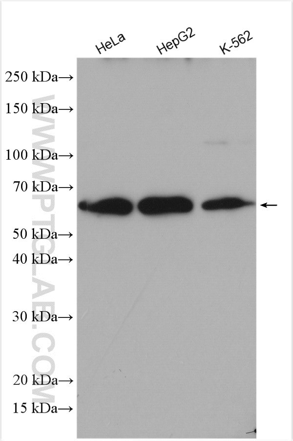 FASTKD2 Antibody in Western Blot (WB)