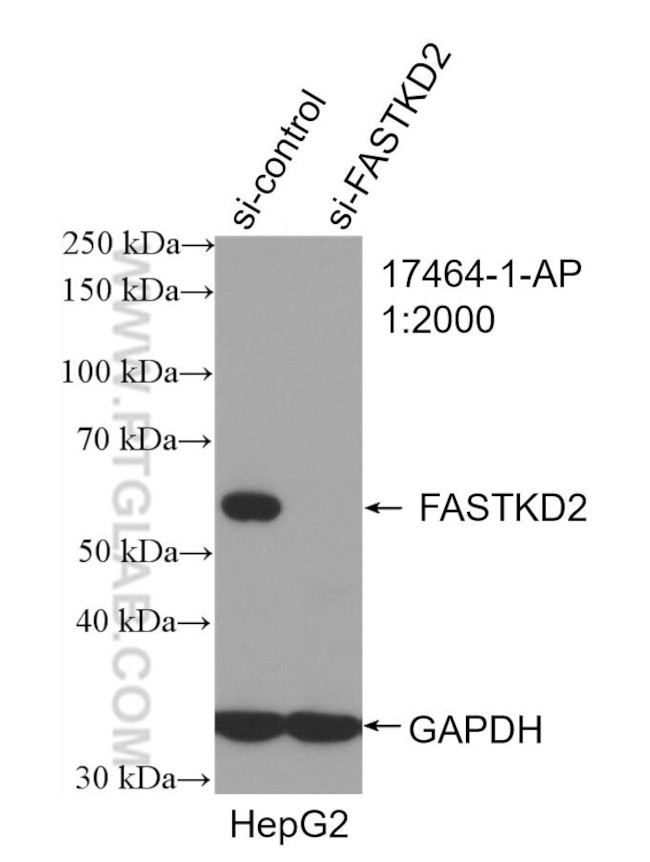 FASTKD2 Antibody in Western Blot (WB)