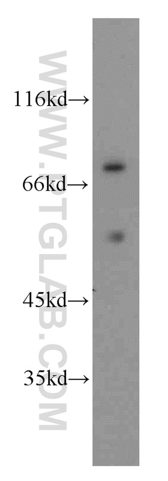 FASTKD2 Antibody in Western Blot (WB)