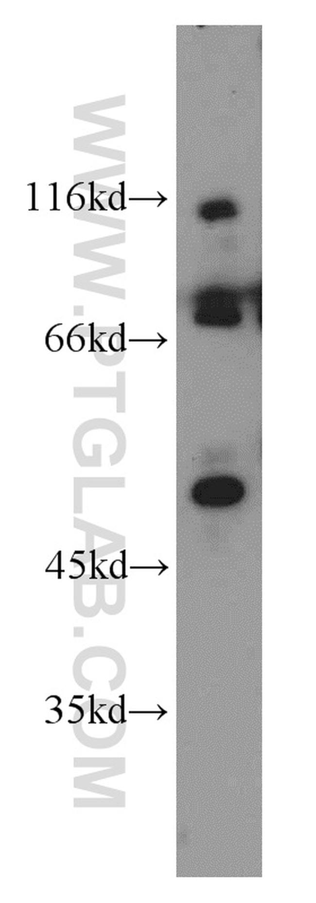 FASTKD2 Antibody in Western Blot (WB)