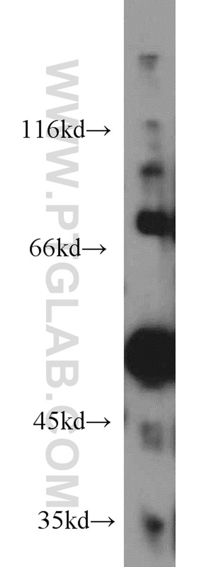 FASTKD2 Antibody in Western Blot (WB)