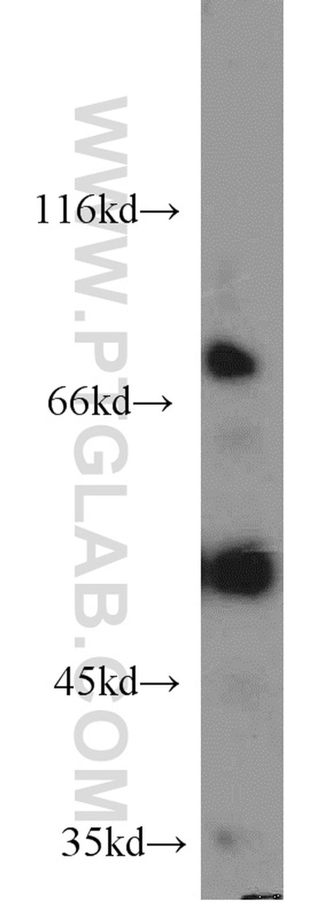 FASTKD2 Antibody in Western Blot (WB)