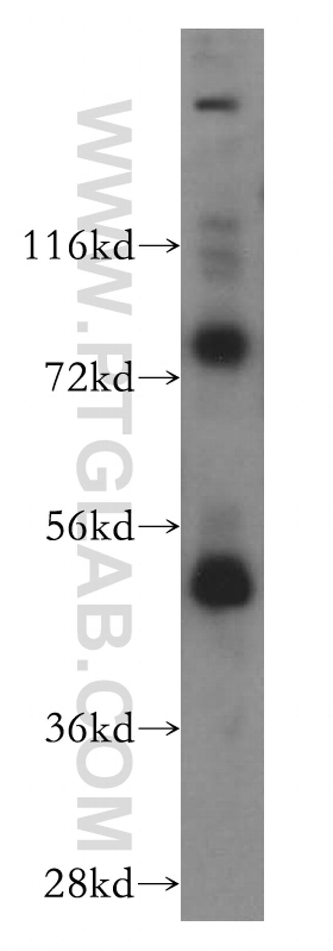 FASTKD2 Antibody in Western Blot (WB)