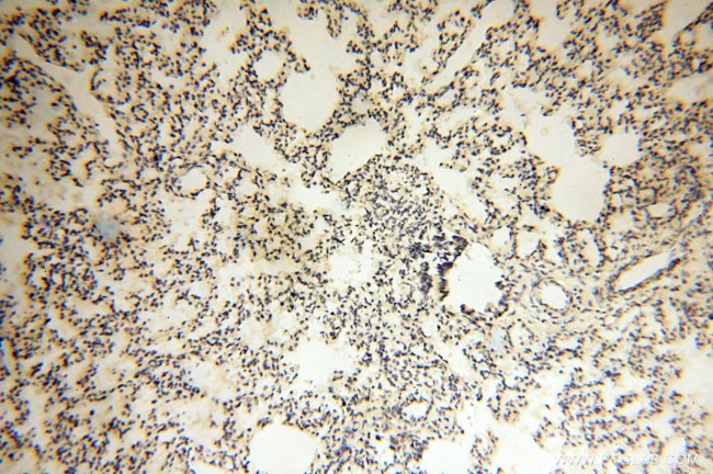 LCORL Antibody in Immunohistochemistry (Paraffin) (IHC (P))