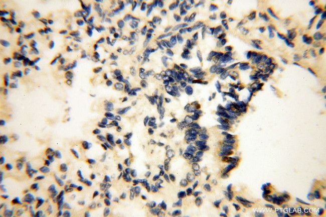 LCORL Antibody in Immunohistochemistry (Paraffin) (IHC (P))