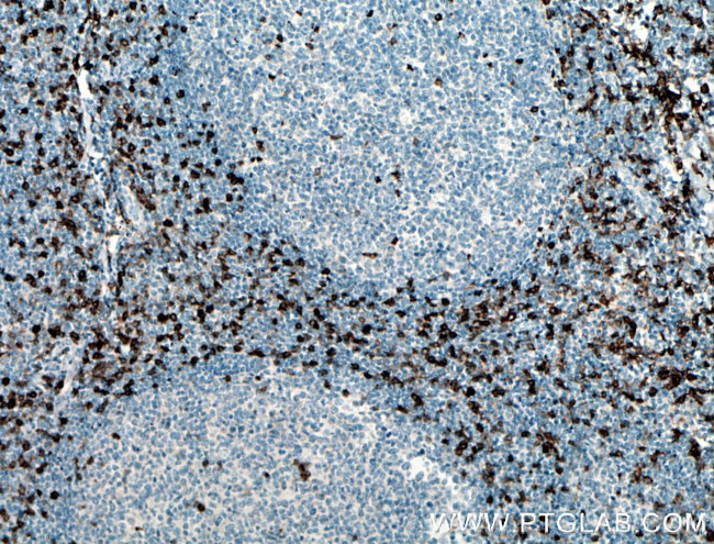 CCR5 Antibody in Immunohistochemistry (Paraffin) (IHC (P))