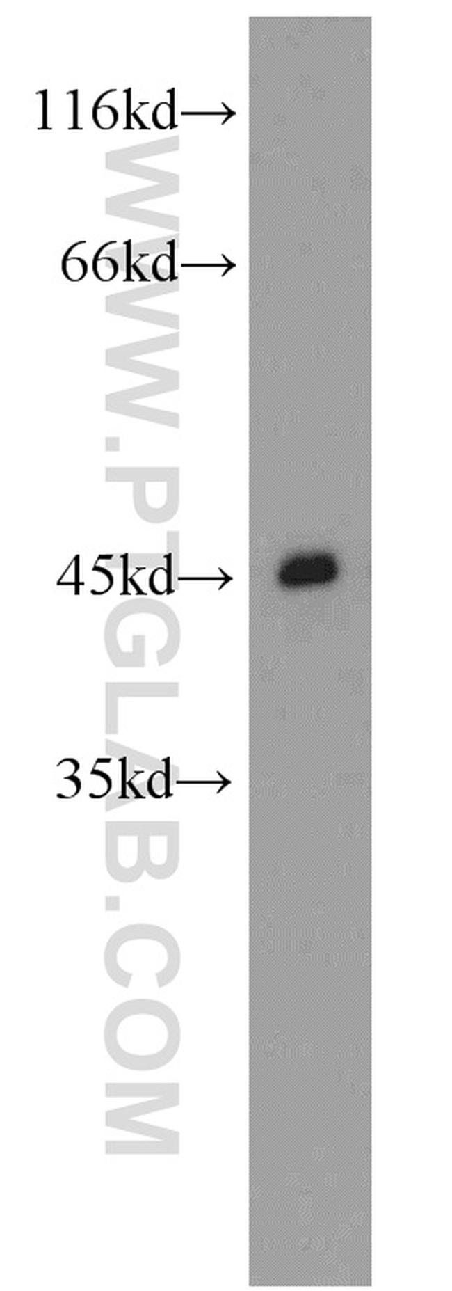 CCR5 Antibody in Western Blot (WB)