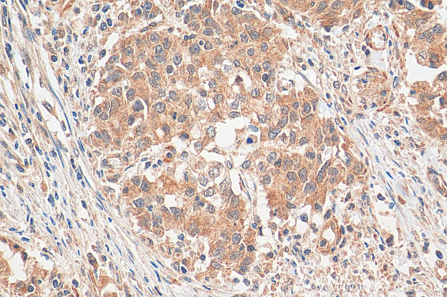 ANUBL1 Antibody in Immunohistochemistry (Paraffin) (IHC (P))