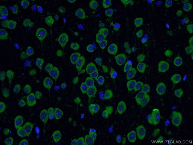 YTHDF1 Antibody in Immunohistochemistry (PFA fixed) (IHC (PFA))