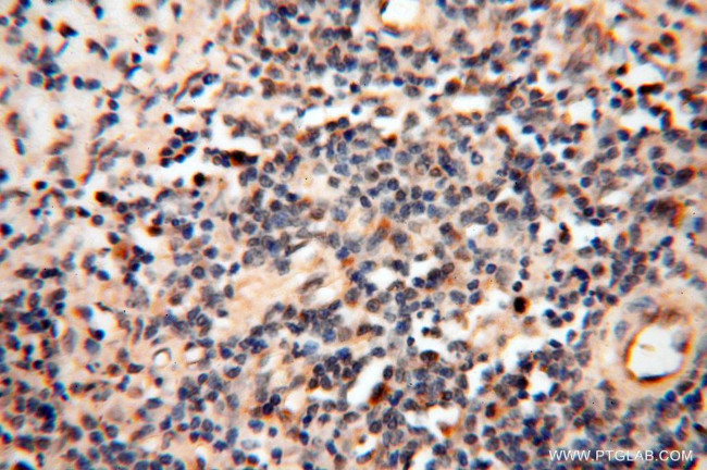 YTHDF1 Antibody in Immunohistochemistry (Paraffin) (IHC (P))