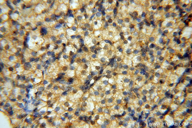 YTHDF1 Antibody in Immunohistochemistry (Paraffin) (IHC (P))