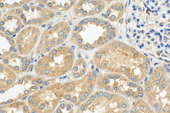 YTHDF1 Antibody in Immunohistochemistry (Paraffin) (IHC (P))