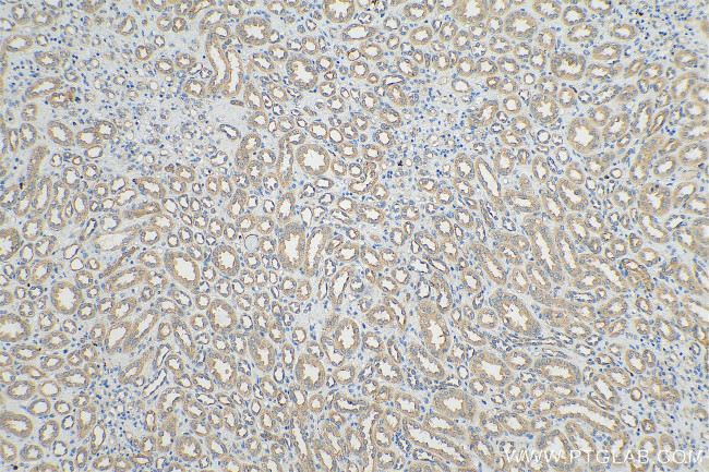 YTHDF1 Antibody in Immunohistochemistry (Paraffin) (IHC (P))