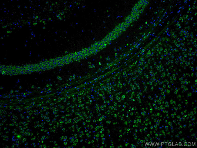 YTHDF1 Antibody in Immunohistochemistry (PFA fixed) (IHC (PFA))