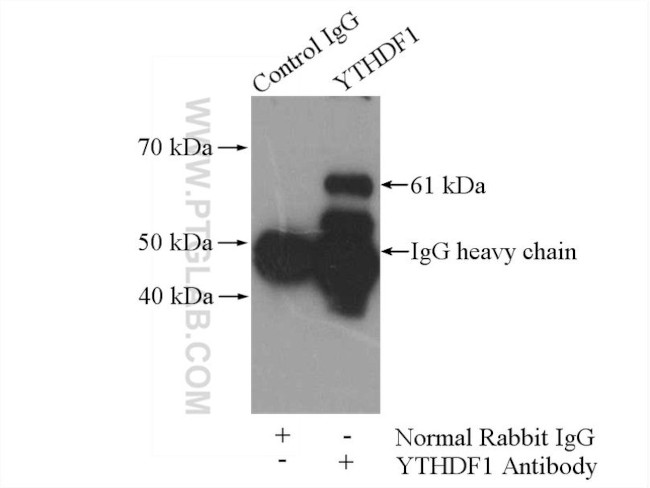 YTHDF1 Antibody in Immunoprecipitation (IP)