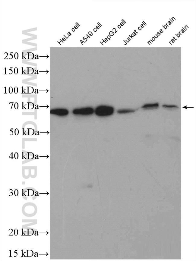 YTHDF1 Antibody in Western Blot (WB)