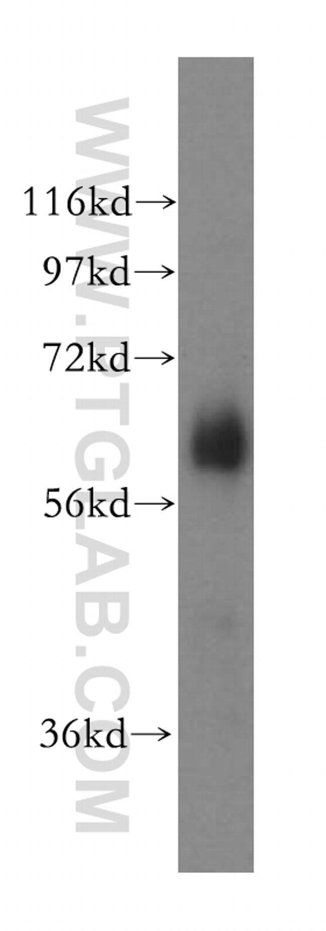 YTHDF1 Antibody in Western Blot (WB)