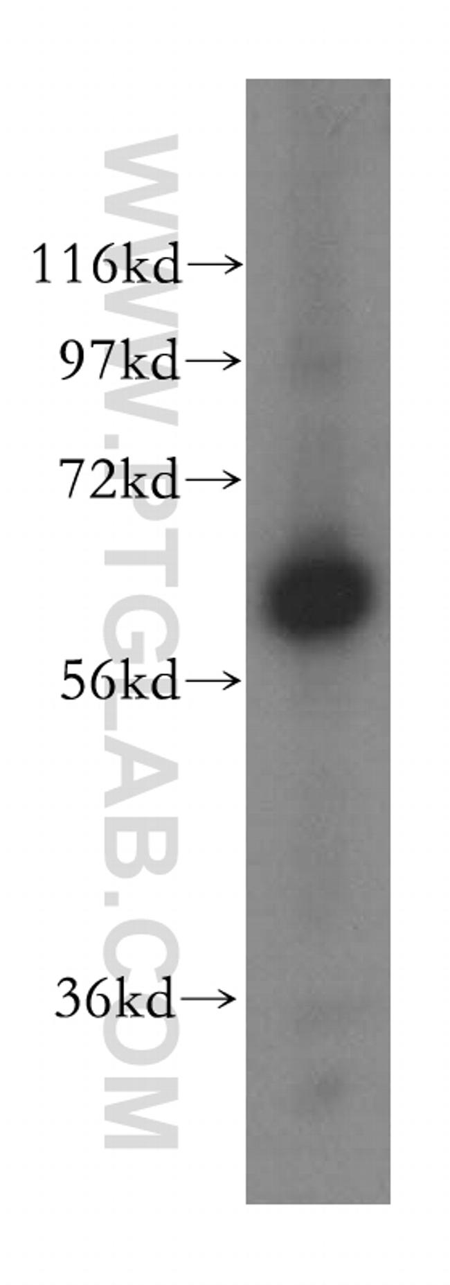 YTHDF1 Antibody in Western Blot (WB)