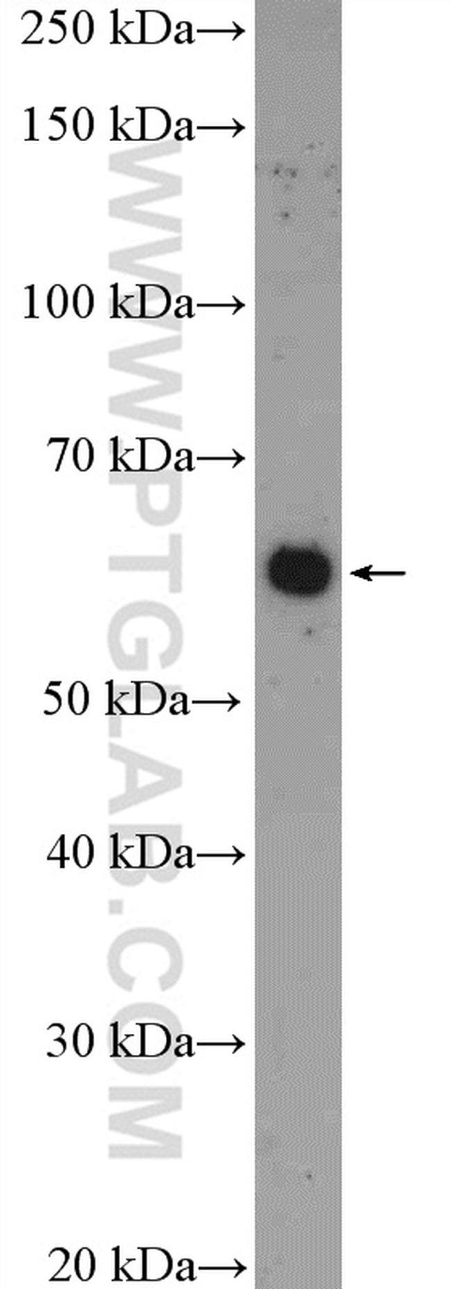 YTHDF1 Antibody in Western Blot (WB)