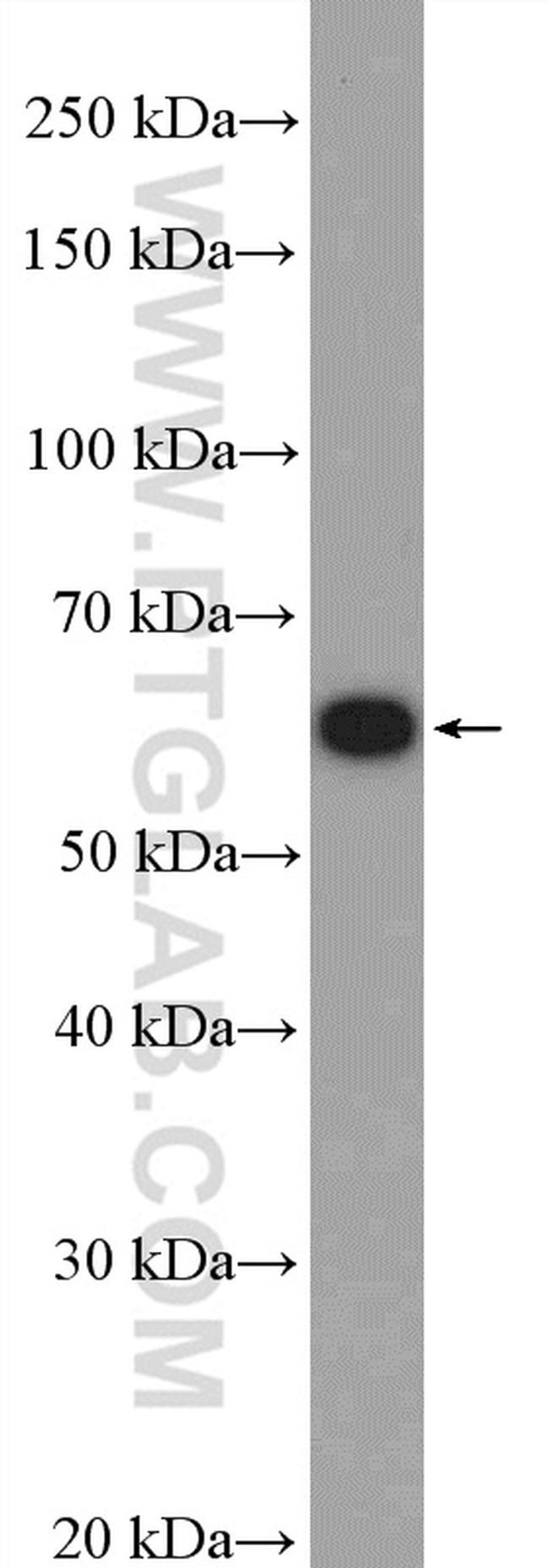 YTHDF1 Antibody in Western Blot (WB)