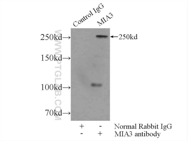 MIA3 Antibody in Immunoprecipitation (IP)