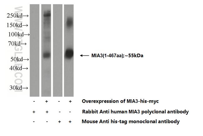 MIA3 Antibody in Western Blot (WB)