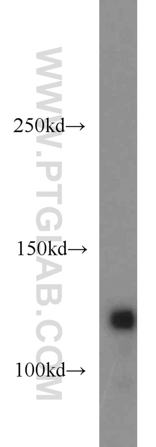 LUZP1 Antibody in Western Blot (WB)