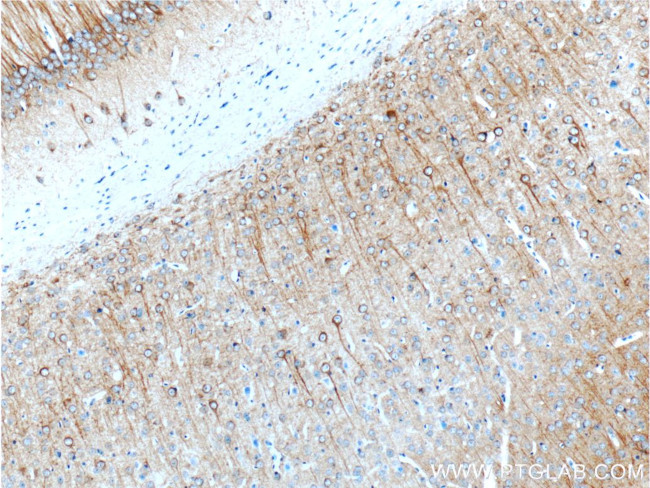 MAP2 Antibody in Immunohistochemistry (Paraffin) (IHC (P))