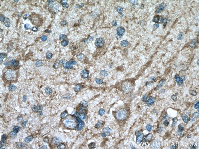 MAP2 Antibody in Immunohistochemistry (Paraffin) (IHC (P))