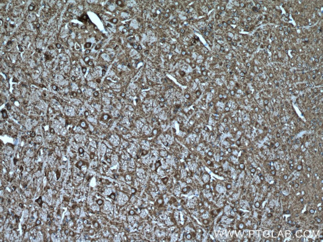 MAP2 Antibody in Immunohistochemistry (Paraffin) (IHC (P))