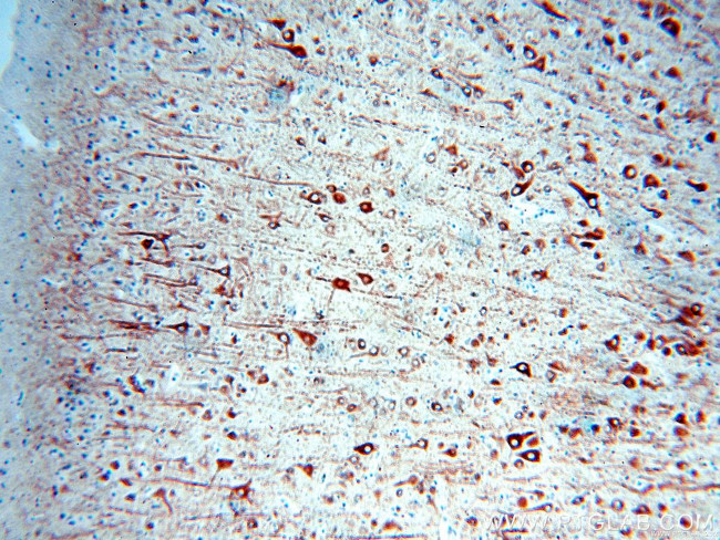 MAP2 Antibody in Immunohistochemistry (Paraffin) (IHC (P))