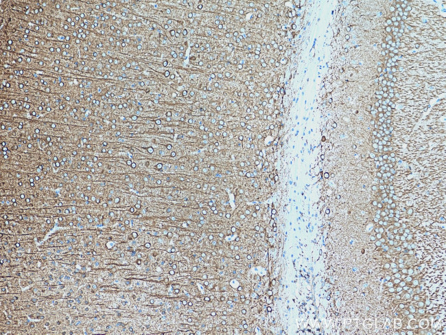 MAP2 Antibody in Immunohistochemistry (Paraffin) (IHC (P))