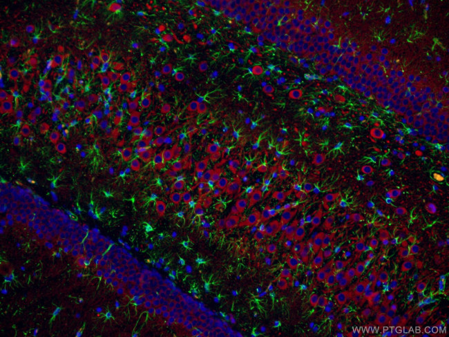 MAP2 Antibody in Immunohistochemistry (PFA fixed) (IHC (PFA))