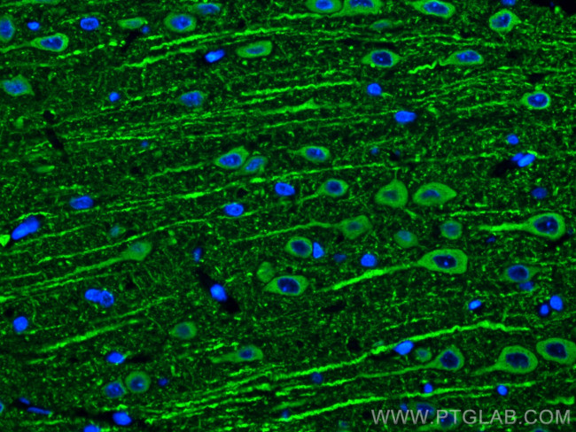 MAP2 Antibody in Immunohistochemistry (PFA fixed) (IHC (PFA))