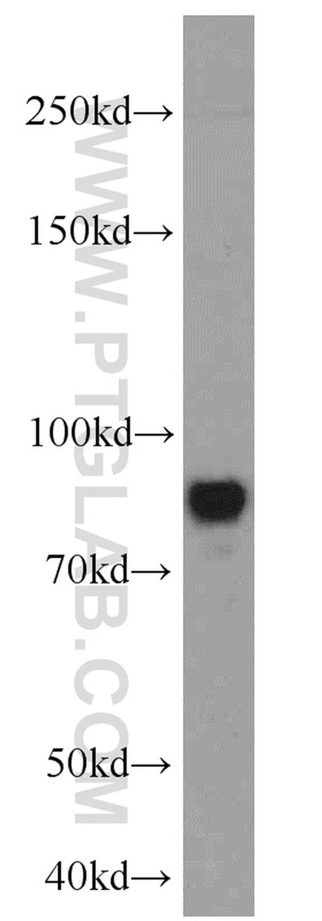 MAP2 Antibody in Western Blot (WB)