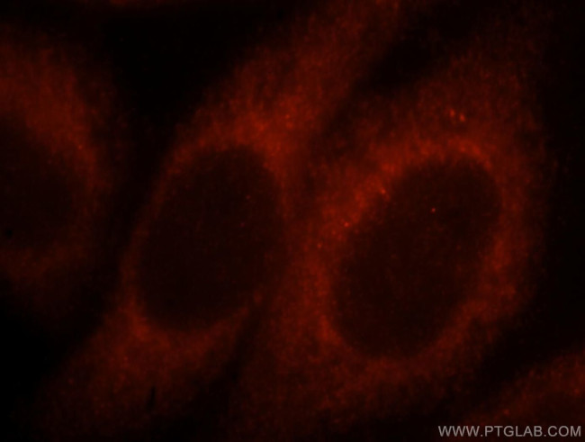 MYO1A Antibody in Immunocytochemistry (ICC/IF)