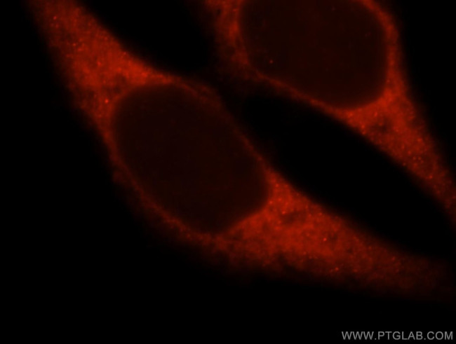 MYO1A Antibody in Immunocytochemistry (ICC/IF)